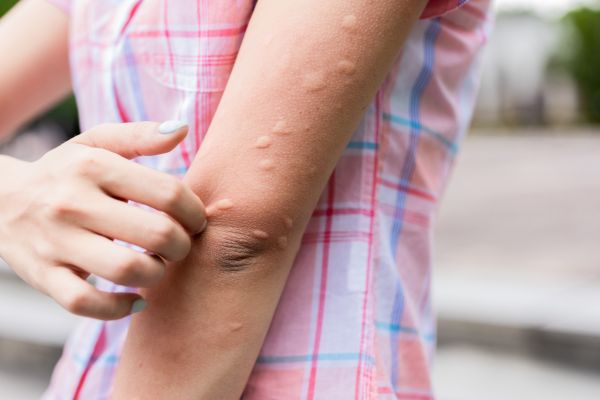 Stinging Insects Removal